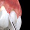 This clear and useful application developed with 3D videos depicts the periodontal plastic surgical technique: the coronally advanced flap for the treatment of gingival recessions