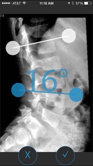 SAGI(SM) Clinical Solutions Lordosis Measurement Application(圖5)-速報App