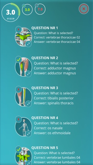 Anatomy Quiz - muscles and bones(圖4)-速報App