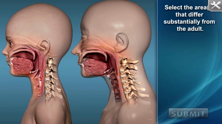 Medrills: Pediatric Considerations screenshot-4