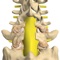 mLumbarLaminectomy is an information resource for the surgical procedure known as a lumbar laminectomy