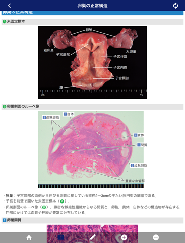 正常画像と比べてわかる病理アトラスのおすすめ画像1