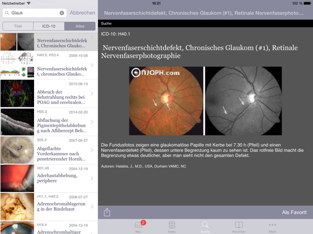 Atlas of Ophthalmology HD by Onjoph(圖5)-速報App