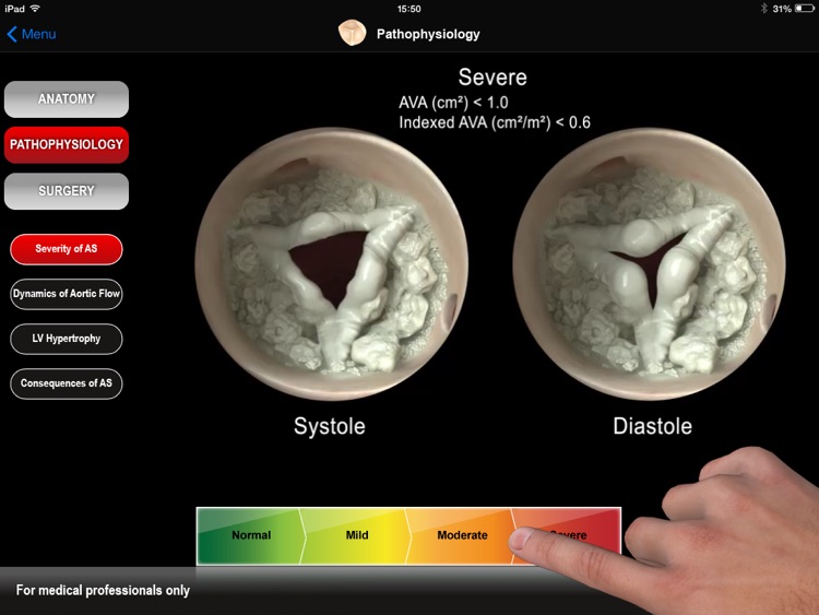 HEART MASTER Aortic Stenosis screenshot-3