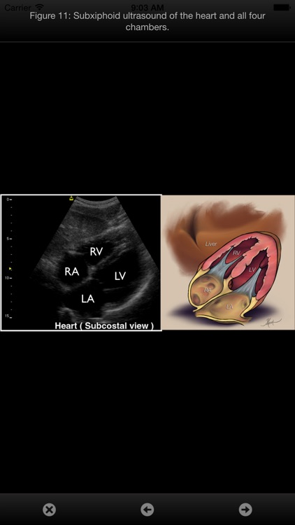 SonoSupport: a clinical emergency medicine and critical care ultrasound reference tool screenshot-4