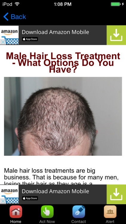 Hair Loss Treatment , Prevention and Cure