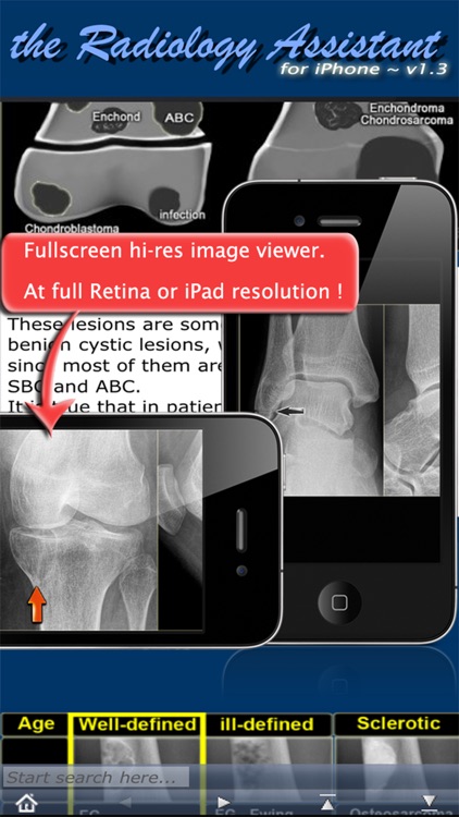 Radiology Assistant - Medical Imaging Reference