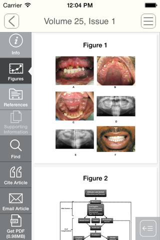 Journal of Prosthodontics screenshot 4