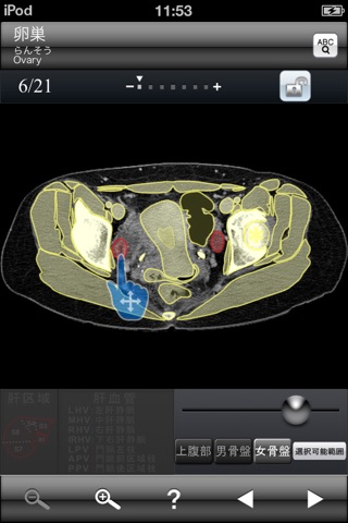 断面図ウォーカー女性骨盤CT無料版 screenshot 2
