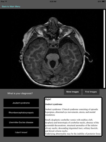 Congenital Central Nervous System Malformations screenshot 4