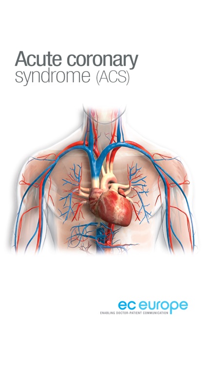 Miniatlas Acute Coronary Syndrome