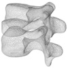 Skeletal Dysplasia Viewer: Spine