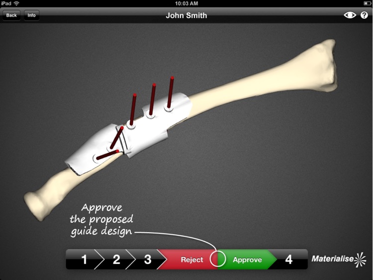 SurgiCase Connect screenshot-4