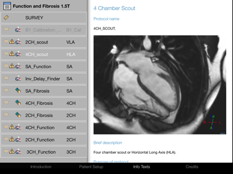 Cardiac MRI - Function & Fibrosis Imagingのおすすめ画像4