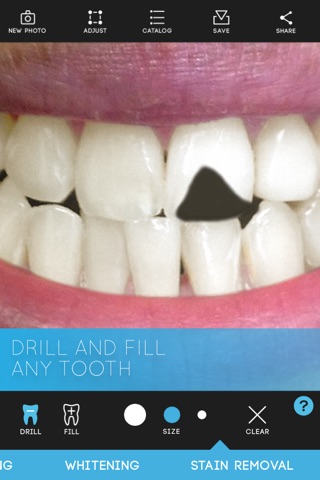Virtual Dentist - Premium Edition screenshot 4