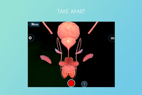 Vasectomy 3D screenshot 2