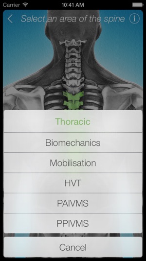 Dynamic Spine(圖2)-速報App