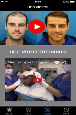 Best Hair Transplant Pre-Procedure, Preparation and Process Guide & Tips Made Easy for Beginners screenshot 3