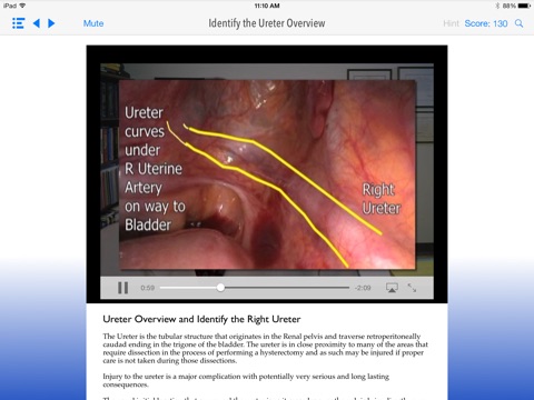 SimPraxis Lap Hysterectomy Trainer screenshot 2