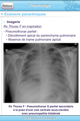 SMARTfiches Pneumologie screenshot 2