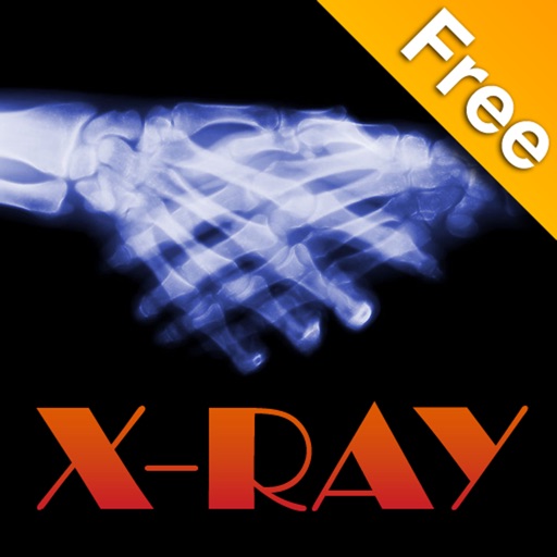 X Ray free for iPhone icon