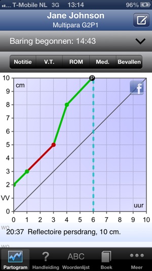 Partogram