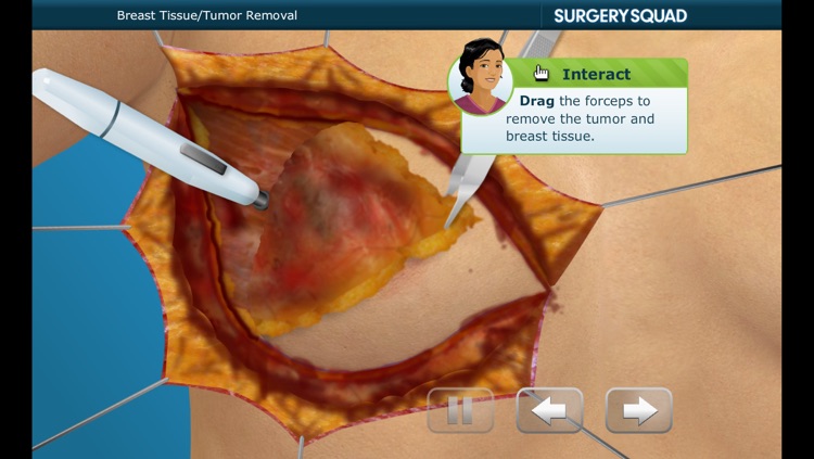 Surgery Squad's Mastectomy screenshot-3