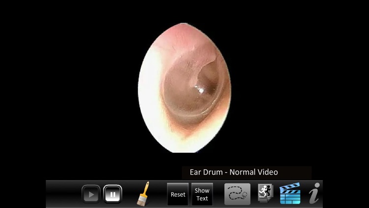 Ear ID