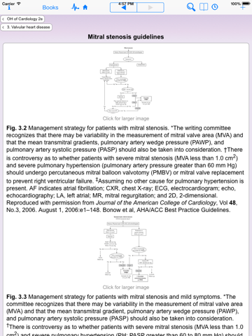 Oxford Handbook of Cardiologyのおすすめ画像3