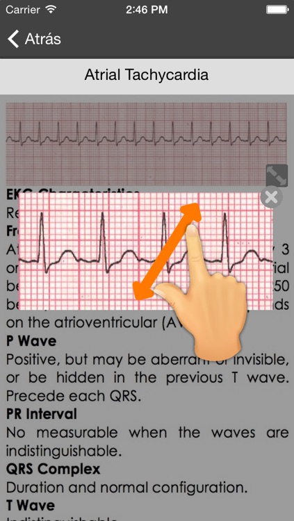 EKG Clínico