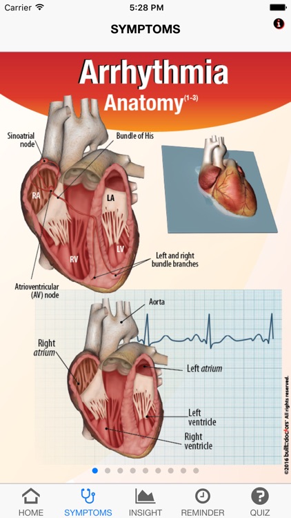 Signs & Symptoms Arrhythmias