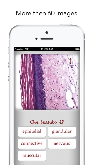 Histology Worldwide Test(圖2)-速報App