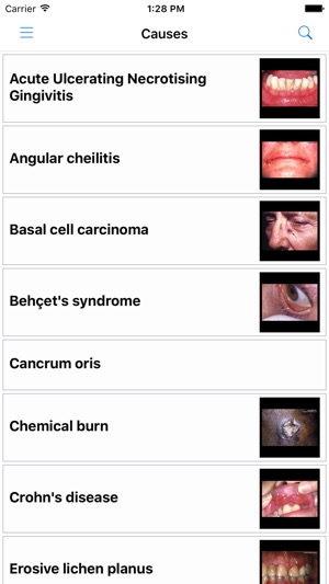 Key to the Diagnosis of Oral Ulceration(圖4)-速報App