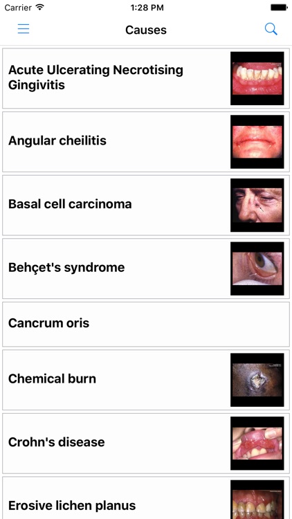 Key to the Diagnosis of Oral Ulceration screenshot-3