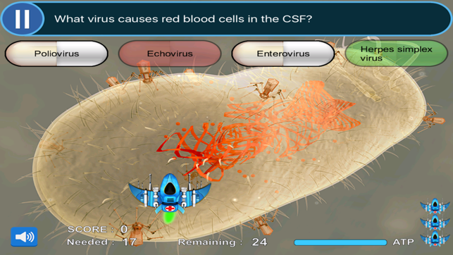 Clinical Neurology & Neuroscience Review Game for the USMLE (圖4)-速報App