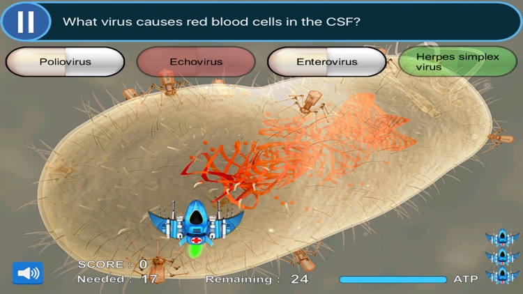 Clinical Neurology & Neuroscience Review Game for the USMLE Step 2 CK & COMLEX Level 2 CE screenshot-3