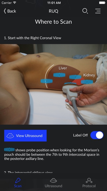 RESUS Ultrasound LITE