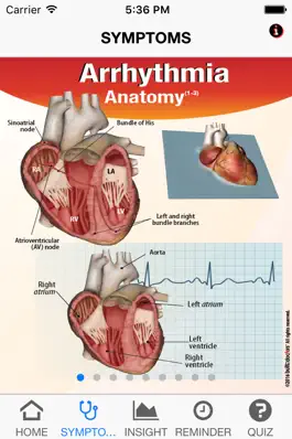 Game screenshot Signs & Symptoms Arrhythmias apk