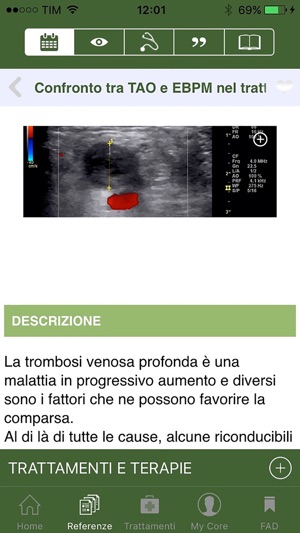 CoreMed Flebologia(圖3)-速報App