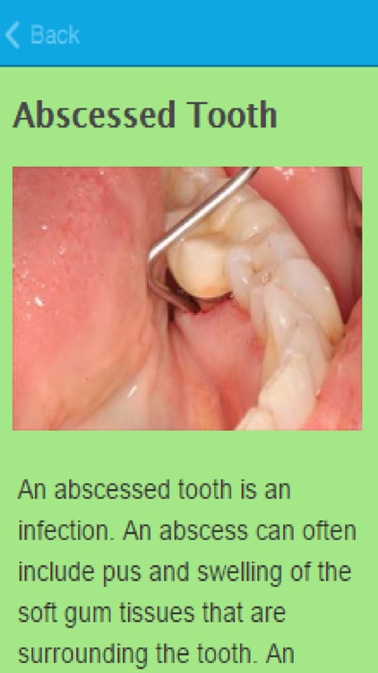 How To Treat An Abscess