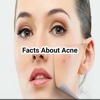 About Acne