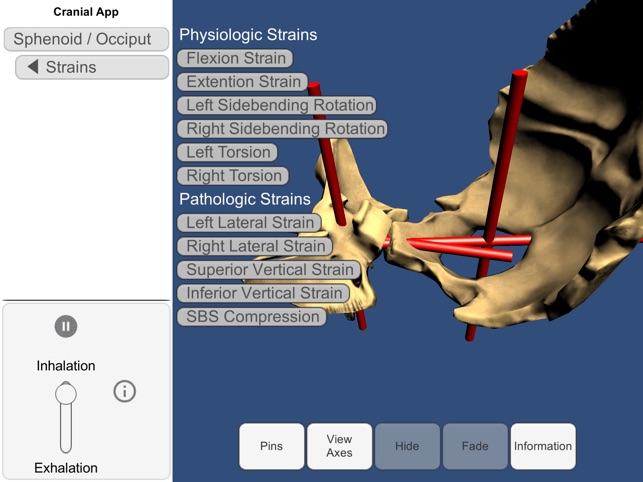 3D Osteopathic Cranial