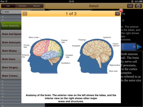 Encyclopedia of Neurological Disorders screenshot 2