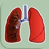 DPOC - Doença Pulmonar Obstrutiva Crônica - TelessaúdeRS