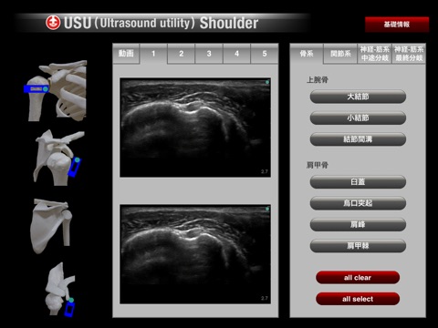 USU Shoulder screenshot 2