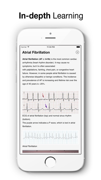ECG Test Pro screenshot-4