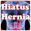 Hiatus Hernia Disease