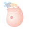 Oncoplastic Breast Surgery is a METHOD, a technical refinement, and a philosophy of treatment