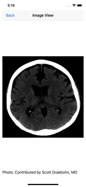 Neurosurgery Board Review(圖7)-速報App