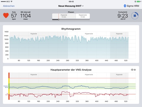 VNS Analyse RT screenshot 2